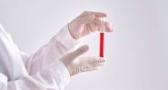'Gwada Negative:' A French Woman’s Unique Blood Group Challenges Medical Science