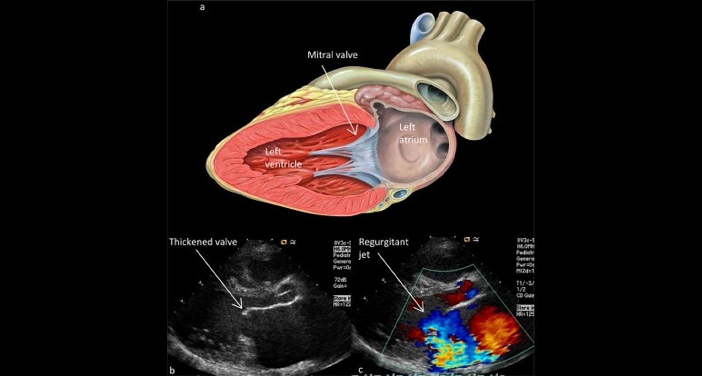 Heart: Operating Better, Faster — DeBakey’s Legacy, the Lebanese Trajectory