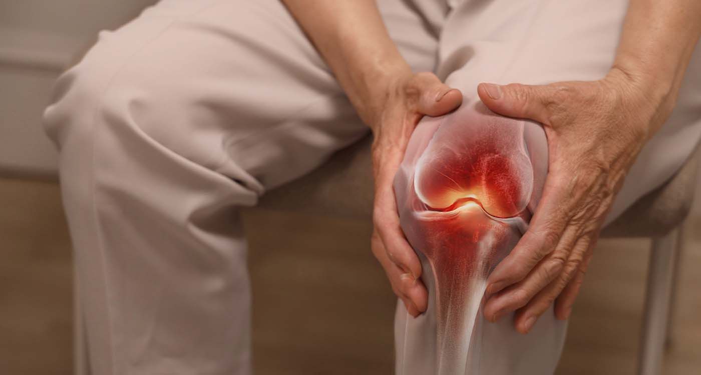 GLP-1: The Unexpected Weapon Against Knee Osteoarthritis