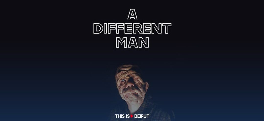 ‘A Different Man:’ Beauty and Disability Redefined Together