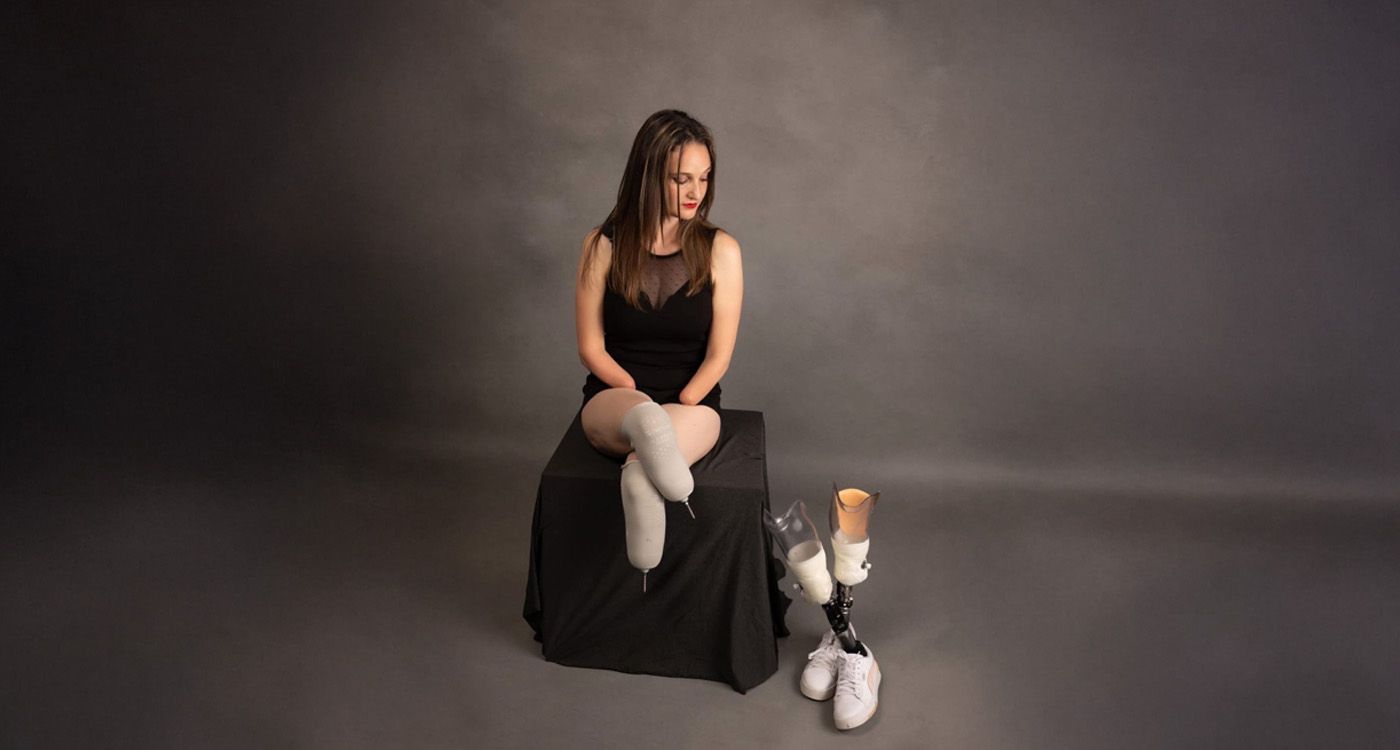 Lucie Retail, Quadruple Amputee: ‘I Feel More Woman Than Ever’