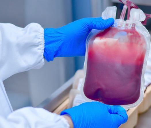 Blood Supply Shortages: Unit Exceeding $100 