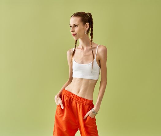 #SkinnyTok: Anorexia Reflected in a Wordless Screen