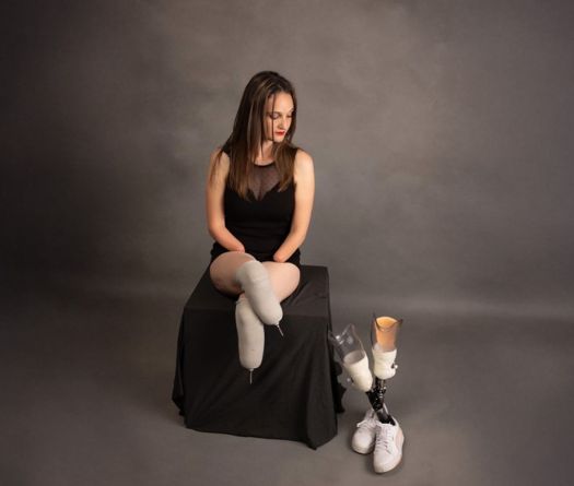 Lucie Retail, Quadruple Amputee: ‘I Feel More Woman Than Ever’