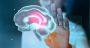Quand l’IA affronte Alzheimer: le pari millionnaire de Bill Gates