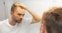 SCUBE3, la molécule qui promet de réveiller les cheveux endormis